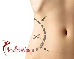 Slider image (8) Paalvi Centre for Advanced Cosmetic Surgery